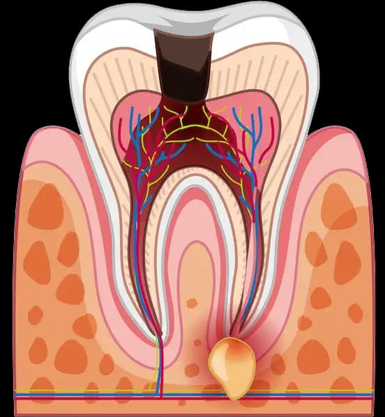 endoimage