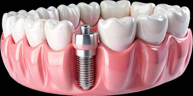 implantservicesimage
